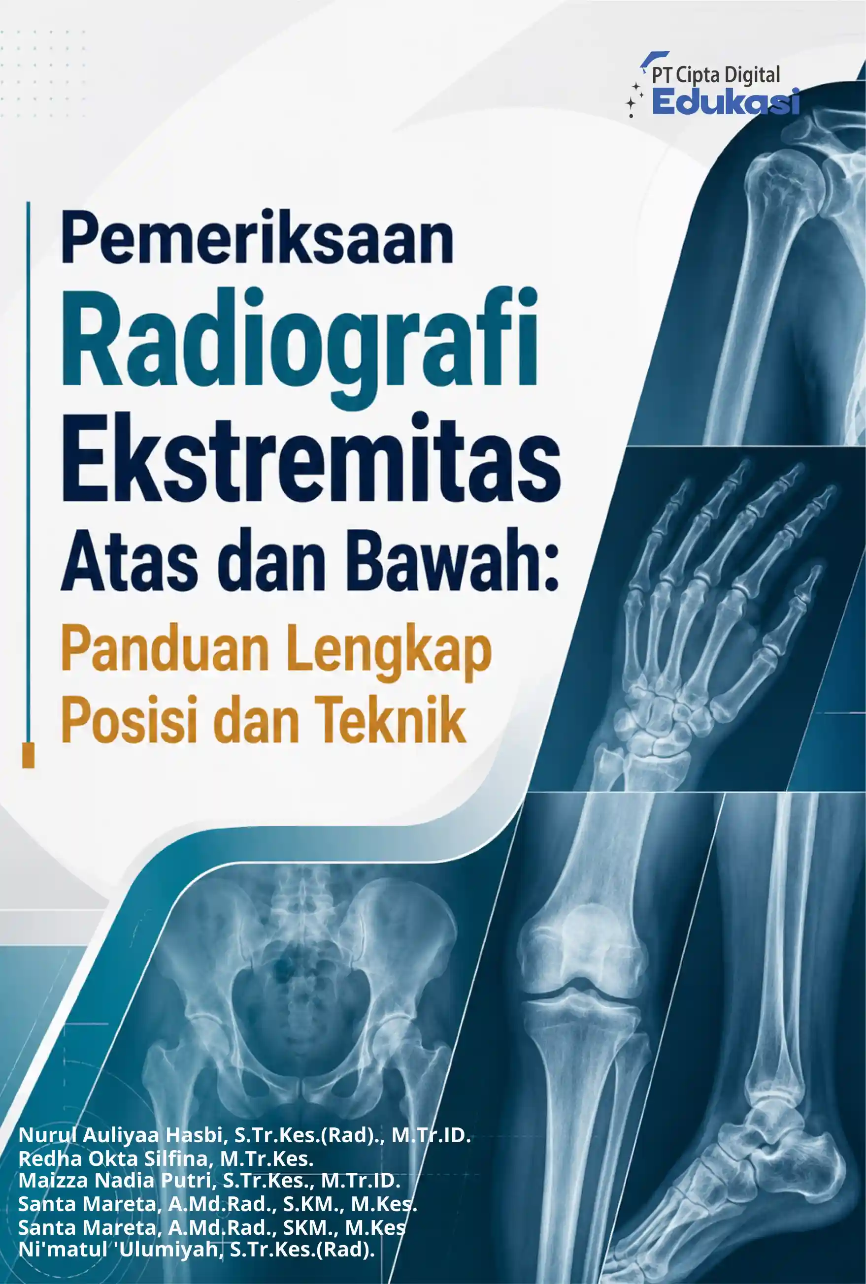 Pemeriksaan Radiografi Ekstremitas Atas dan Bawah: Panduan Lengkap Posisi dan Teknik